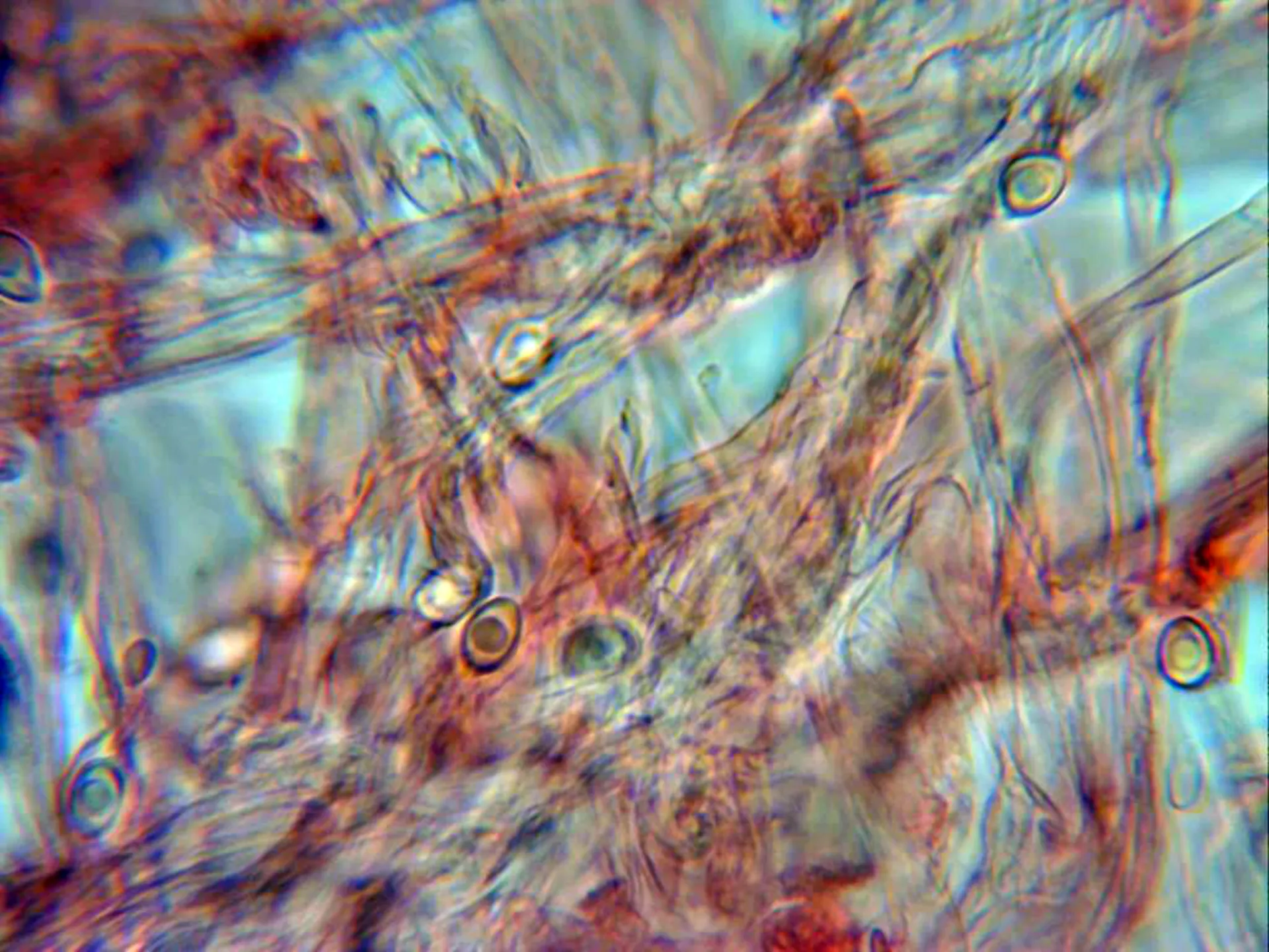 Microscopía de Leucoagaricus serenus - 4 - Hifas cutícula
